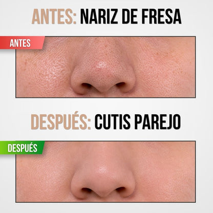 REMOVEDOR DE PUNTOS NEGROS PARA LIMPIEZA FACIAL PROFUNDA | FACELIA™