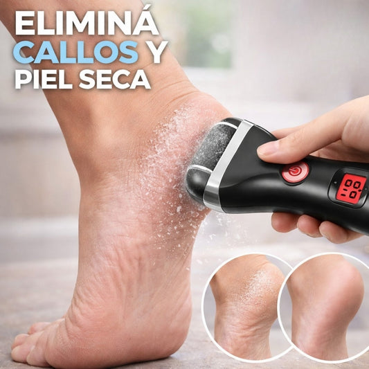 REMOVEDOR DE CALLOS 2 NIVELES | PULIX™